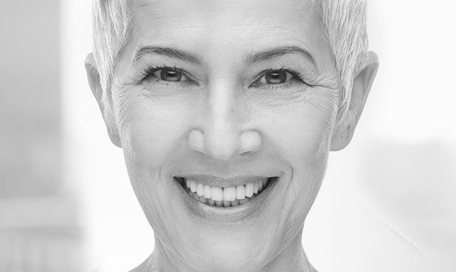 smiling women with dental implants